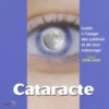 Cataracte. Guide à l'usage des patients et de leur entourage, 2e édition, Christophe Baudouin